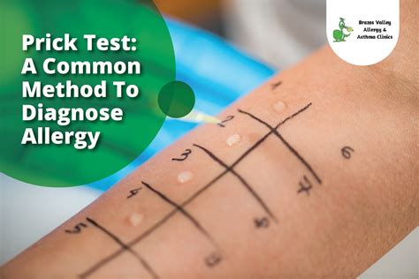 scratch test allergy|allergy tests are administered by.